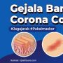 INFOGRAFIS : Gejala Baru Virus Corona Covid-19!