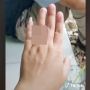 Haru! Belum Bisa Melamar, Pria Ini Persembahkan Cincin Tak Biasa untuk Pacar