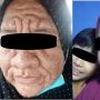 Sampai Disumpahin, Perempuan Alami Wajah Menua Mirip Nenek-Nenek Selama Kehamilan