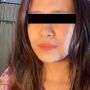 Viral Cewek Dihina Bagian Tubuhnya Ini Mirip Logo BTS, Reaksinya Disorot