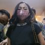 Jadi Tersangka, Rachel Vennya Tak Ditahan, Polisi: Ancamannya Cuma Satu Tahun