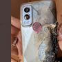 HP OnePlus Meledak, Lukai Seorang Bocah Laki-laki di India
