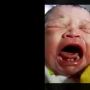 Peristiwa Langka, Bayi Baru Lahir Sudah Punya Gigi