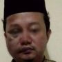 Foto Herry Wirawan Bonyok Dalam Rutan Beredar, Della Puspita: Nitip Kulitin, Sisain Tipis