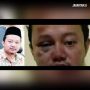Herry Wirawan Pemerkosa Santri Dicukur Gundul, Diterungku Bersama Begal