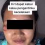 Wajah Pengantin Luka karena Kecelakaan, Hasil Riasan MUA Jadi Perbincangan