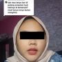Viral Cewek Cerita Pilu Nasib Kakinya Setelah Diamputasi Dibawa Ayah