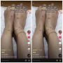 Gegara Pindah Kos, Wanita Syok Lihat Sekujur Tubuh Dipenuhi Bentol, Ternyata Karena Ini