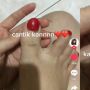 Keseringan Gunakan Fake Nails, Kuku Wanita Ini Berjamur Hingga Terkikis