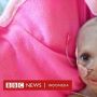 Perang Saudara di Etiopia: RS di Tigray Kehabisan Makanan untuk Anak