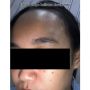 Curhat Wanita Alami Kekerasan Fisik Dianiaya Pacar, 'di Mata Kelihatan Darah Mati'