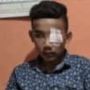 Bocah SMP di Gresik Kepalanya Sampai Sobek Setelah Dikeroyok Temannya