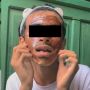 Viral Cowok Cabut Masker Wajah, Berakhir Ngenes Kumis Lenyap sampai Ditonton 29 Juta Kali