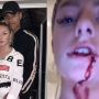 Profil Harriet Robson, Model Cantik Korban Penganiayaan Mason Greenwood