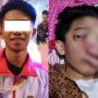 Butuh Bantuan, Atlet Karate Idap Tumor Ganas di Mata Hanya Bisa Terbaring di Tempat Tidur