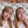 Ngaku Sakit Bipolar dan Dirawat di Rumah Sakit, Medina Zein Belum Bisa Kembalikan Duit Uya Kuya