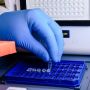 Mengenal PCR, Teknik Molekuler untuk Materi Genetik, Bukan Hanya COVID-19