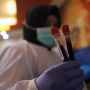 Dokter Beberkan Manfaat Rutin Donor Darah: Cegah Penyakit Jantung Hingga Bantu Selamatkan Nyawa
