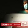 Arnold Putra: Desainer Kontroversial yang Diduga Pesan Organ Manusia