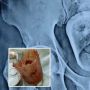 Dokter Syok dan Heran Temukan Gelas di Perut Pria ini, Mengaku Tak Sengaja Lakukan Hal ini saat Minum Teh, Kok Bisa?