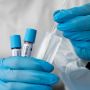 Mengenal CT Value Covid-19 dalam Hasil Tes PCR, Benarkah Ada Hubungannya dengan Keparahan Penyakit?