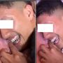 Secara Tak Sengaja Behel Pria Ini Nyangkut di Sarung Bantal, Berakhir Lemas dan Malu Karena Sulit Lepas
