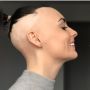 Rambut Perempuan Rontok Hingga Hampir Botak Usai Tes Pap Smear, Kenapa?