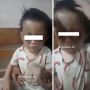 Kebangetan! Ibu Tega Aniaya Anak Gara-gara Buang Air Kecil di Celana, Matanya Sampai Bengkak Membiru