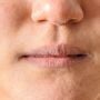 4 Kebiasaan yang Menyebabkan Bibir Terasa Kering dan Pecah-pecah