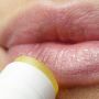 Perempuan Wajib Tahu, Ini Penyebab dan Gejala Alergi Lipstik!