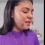 Viral! Perempuan Ini Diculik Mantan Kekasih, Dipaksa Tato Wajah Dengan Nama Sang Mantan