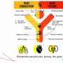 Tanda-Tanda Heat Stroke, Jemaah Haji Wajib Waspadai Gejala Ini Ketika Cuaca Panas