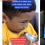 Takut Makan Nasi, Bocah 5 Tahun Ini Cuma Makan Wafer dan Snack