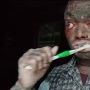 Heboh! Dijuluki Manusia Ular, Lelaki Ini Punya Kulit Bersisik dan Ganti Setiap Seminggu Sekali