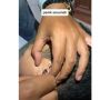 Bukan Serangga, Telinga Bocah Ini Malah Kemasukkan Gigi Gegara Iseng Main