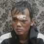 Pemuda Pasuruan Digebuki Sejumlah Orang Gara-gara Tolak Kasih Uang Jatah Preman