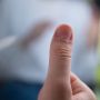5 Cara Menghilangkan Kebiasaan Menggigit Kuku Tangan