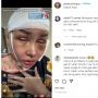 Kondisi Memprihatinkan Lucinta Luna setelah Operasi Potong Leher, Wajah Diperban dan Kesulitan Makan
