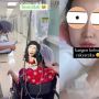 Lucinta Luna Jalani Operasi Ganti Kulit