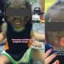 Mengidap Werewolf Syndrome, Tubuh hingga Wajah Bocah Perempuan Ini Ditumbuhi Rambut, Publik: Tetap Cantik