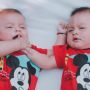 7 Fakta Anak Kembar Siam dengan Otak Menyatu Sukses Dipisahkan di Brasil, Pakai Bantuan Virtual Reality