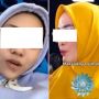 Ibu Mertua Viral di Pengajian Mamah Dedeh, Menantu Akui Cuma Settingan: Pertanyaannya Diberikan oleh Pihak TV