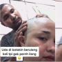 Wanita Ini Botaki Rambut, Perilaku Manis Sang Suami Bikin Adem Istrinya