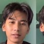 Bikin Nular! Seorang Cowok Ngaku Punya Penyakit Tertawa Tanpa Sebab