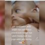 Viral Kulit Bayi yang Beruntusan Dioles Kelly Pearl Cream, Apa Kegunaan Produk Ini?