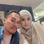 Lepas Hijab, Jennifer Dunn Jawab Tudingan Oplas