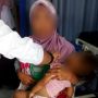 Balita 3 Tahun di Blitar Badanya Lebam-lebam, Diduga Dihajar Orangtua Angkatnya