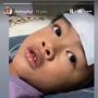 Demam Akibat DBD, Anak Usia 5 Tahun Ini Ngigau Jokowi Bakal Diampuni Dosanya