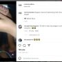 Cium Kelomang, Bibir Bocah Ini Dicapit, Warganet: Trauma Mendalam