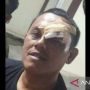 Usut Kasus Penculikan dan Penganiayaan Dua Wartawan, Polres Karawang Akan Bentuk Tim Khusus